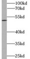 Western Blot