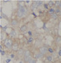 Immunohistochemistry