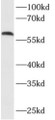 Western Blot