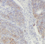 Immunohistochemistry