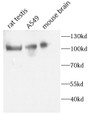 Western Blot