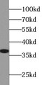 Western Blot