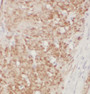 BACE2 Polyclonal Antibody, Cat#CAF50042