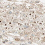 Immunohistochemistry