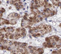 Immunohistochemistry