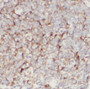 Immunohistochemistry