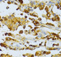 Immunohistochemistry