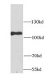 Western Blot