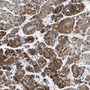 Immunohistochemistry