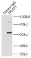 Immunoprecipitation