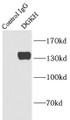 Immunoprecipitation