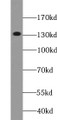 Western Blot