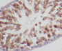 Immunohistochemistry