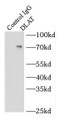 Immunoprecipitation