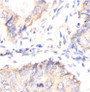 Immunohistochemistry