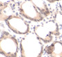 Immunohistochemistry