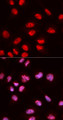 Immunofluorescence