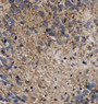 Immunohistochemistry