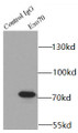 Immunoprecipitation