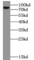 Western Blot