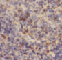 Immunohistochemistry