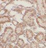 Immunohistochemistry