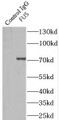 Immunoprecipitation