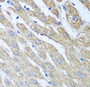 Immunohistochemistry