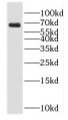 Western Blot