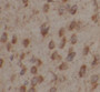 Immunohistochemistry