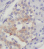 Immunohistochemistry