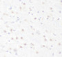 Immunohistochemistry