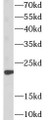 Western Blot