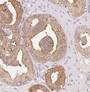 Immunohistochemistry