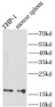 Western Blot