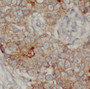 Immunohistochemistry