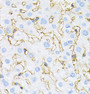 Immunohistochemistry