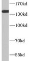 Western Blot