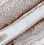 Immunohistochemistry