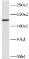 Western Blot