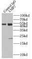 Immunoprecipitation