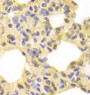 Immunohistochemistry