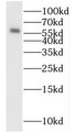 Western Blot