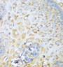 Immunohistochemistry