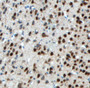 Immunohistochemistry