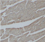 Immunohistochemistry