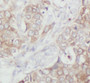 Immunohistochemistry