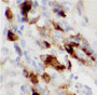 Immunohistochemistry