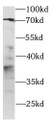 Western Blot