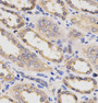 Immunohistochemistry